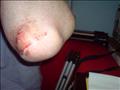 Ow. My elbow hurts